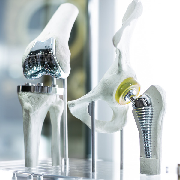 Models of hip and knee joints with metallic prosthetic implants Models of hip and knee joints with metallic prosthetic implants